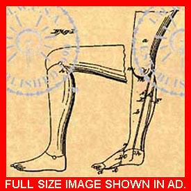 PROSTHETIC LEG   Artificial Foot US Patent #481