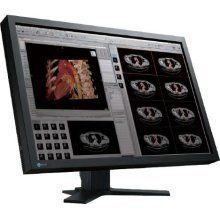 Eizo Flexscan MX300Ws Widescreen Medical Grade Display