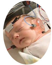 the power of choice in newborn hearing screening all in one abr dpoae